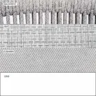 Garden Rocking Armchair Solid and Upholstered Fabric - Smart by Varaschin Viadurini