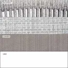 Garden Rocking Armchair Solid and Upholstered Fabric - Smart by Varaschin Viadurini