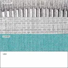 Garden Rocking Armchair Solid and Upholstered Fabric - Smart by Varaschin Viadurini