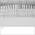 Garden Rocking Armchair Solid and Upholstered Fabric - Smart by Varaschin Viadurini